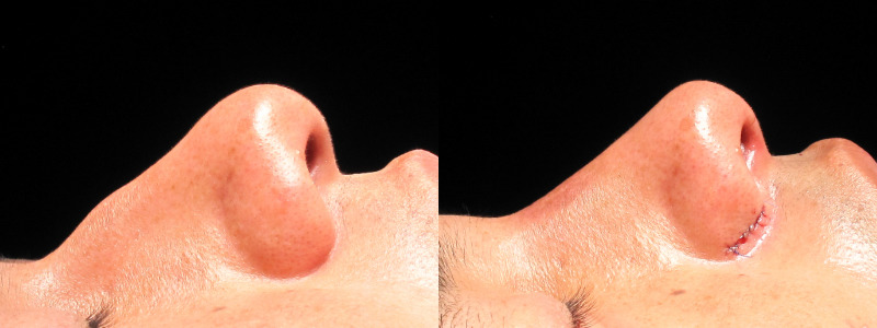 Patient 16 Combined Image