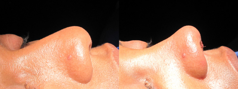 Patient 22 Combined Image