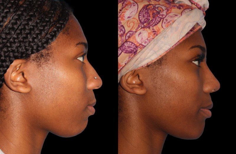 Patient 42 Combined Image