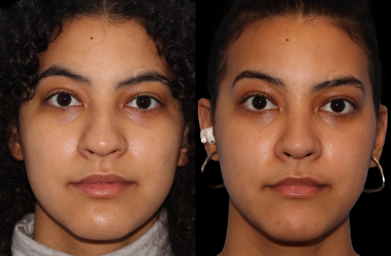 Patient 9 Combined Image