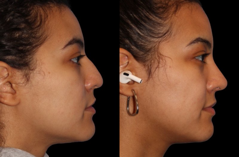 Patient 9 Combined Image