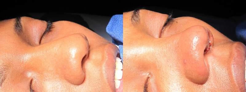 Patient 22 Combined Image