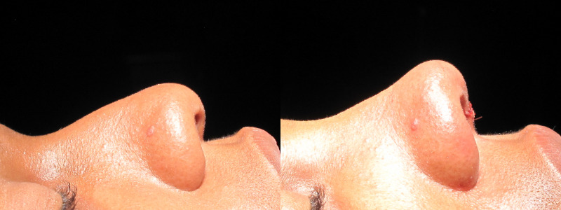 Patient 22 Combined Image