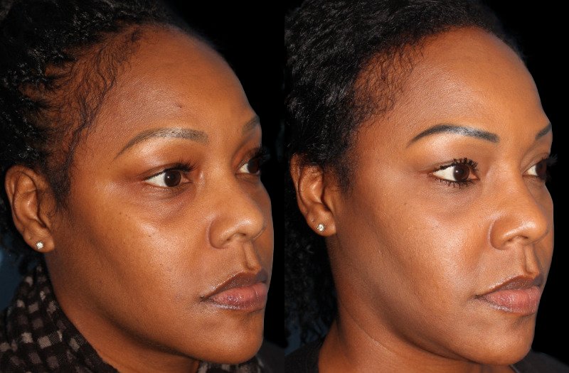 Patient 41 Combined Image