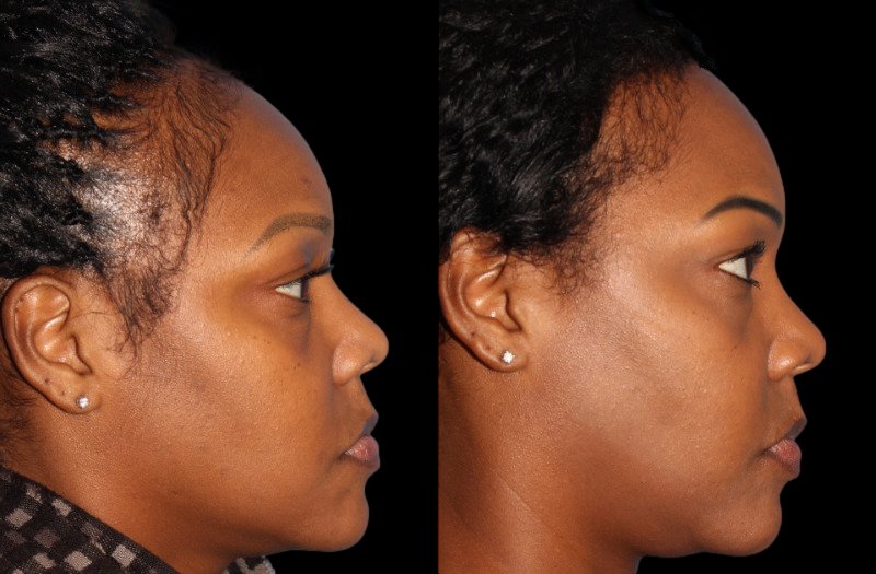 Patient 41 Combined Image