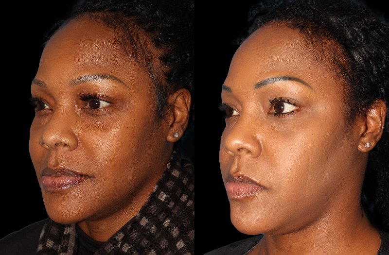 Patient 41 Combined Image