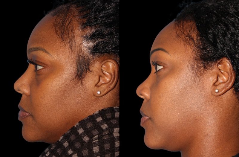 Patient 41 Combined Image