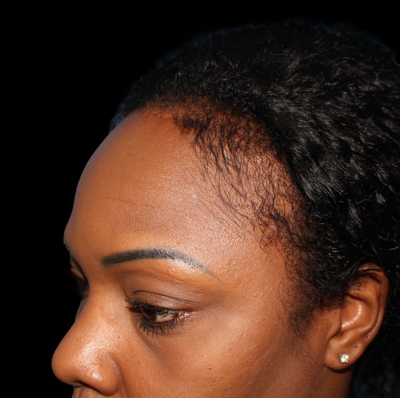 Patient 41 Combined Image