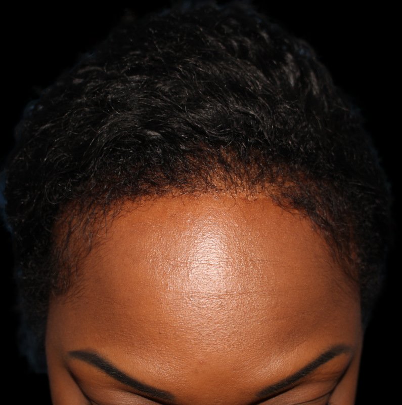 Patient 41 Combined Image