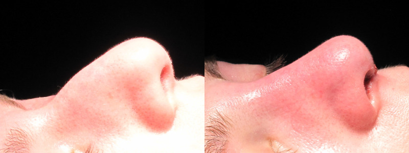 Patient 25 Combined Image