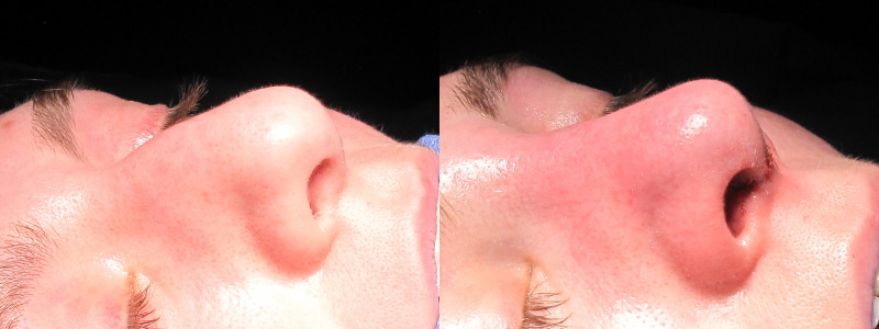 Patient 25 Combined Image