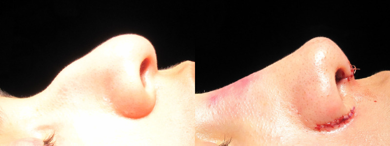 Patient 27 Combined Image