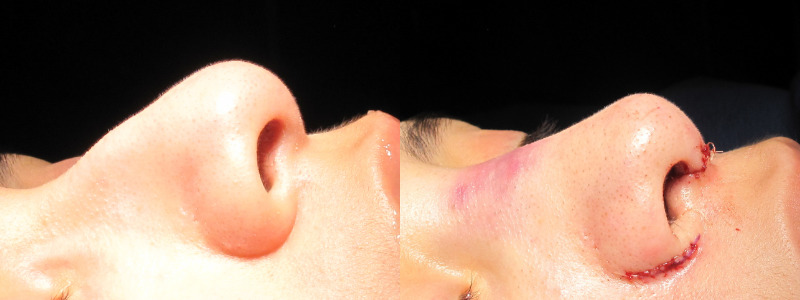 Patient 27 Combined Image