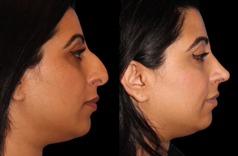 Patient 15 Combined Image