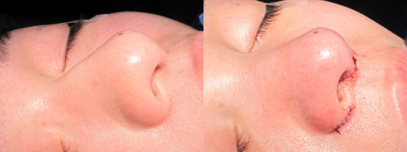 Patient 14 Combined Image