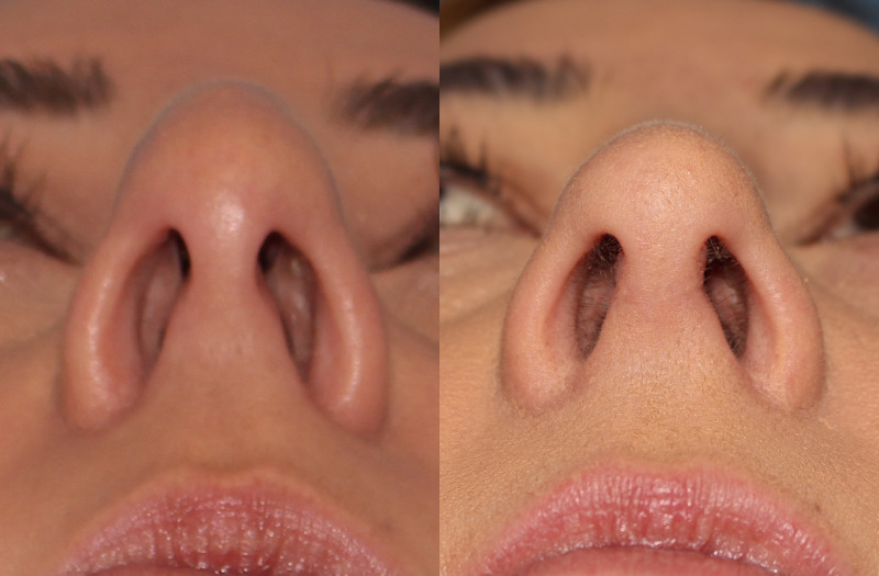 Patient 18 Combined Image