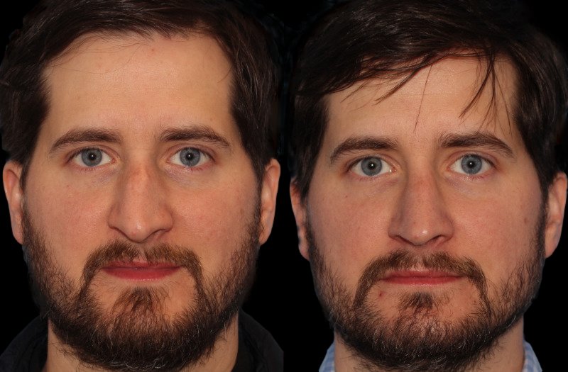 Patient 19 Combined Image