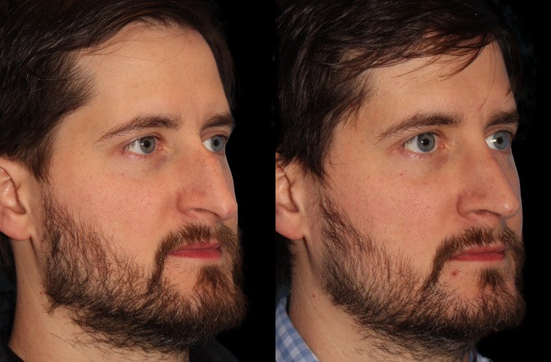 Patient 19 Combined Image