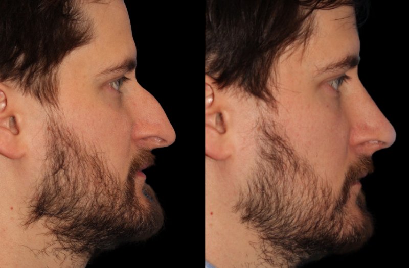 Patient 19 Combined Image