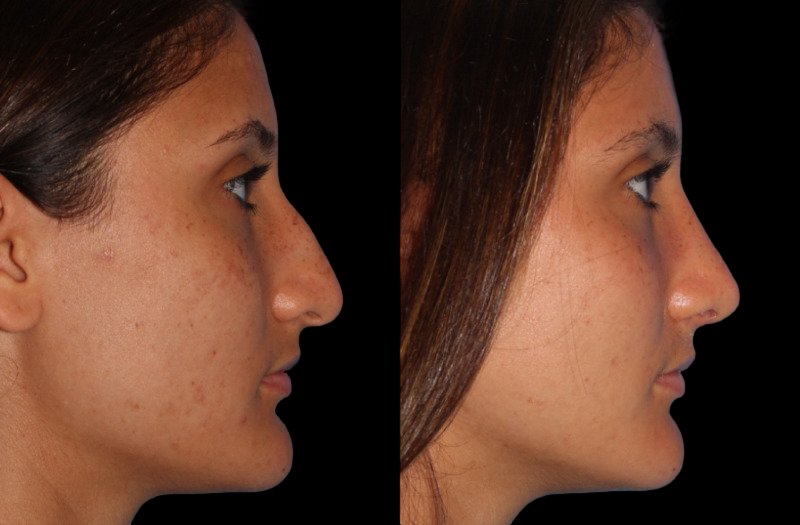 Patient 2 Combined Image