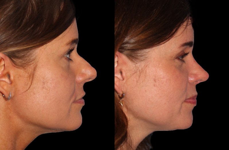 Patient 20 Combined Image