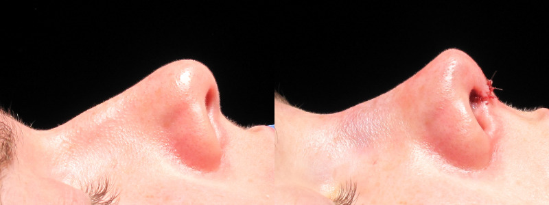 Patient 19 Combined Image