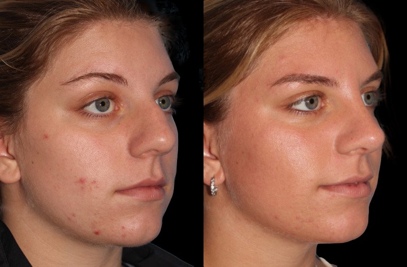 Patient 29 Combined Image