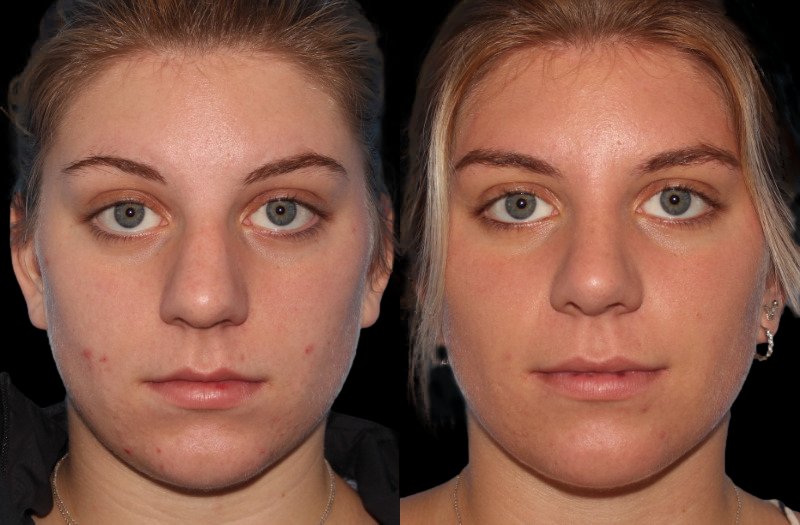 Patient 29 Combined Image