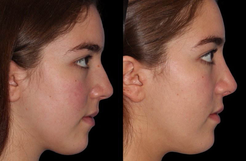 Patient 3 Combined Image