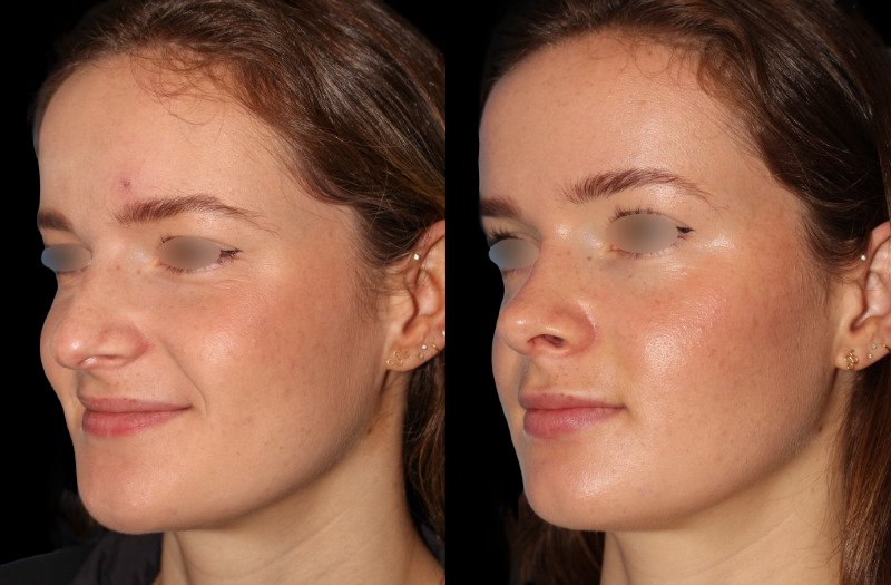 Patient 30 Combined Image