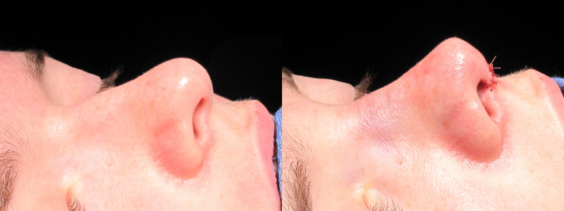 Patient 19 Combined Image