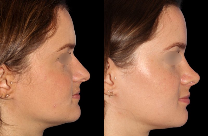 Patient 30 Combined Image