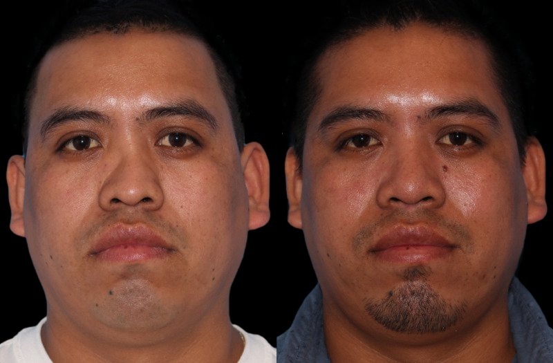 Patient 4 Combined Image