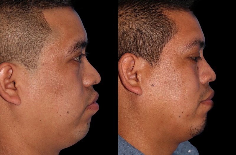 Patient 4 Combined Image