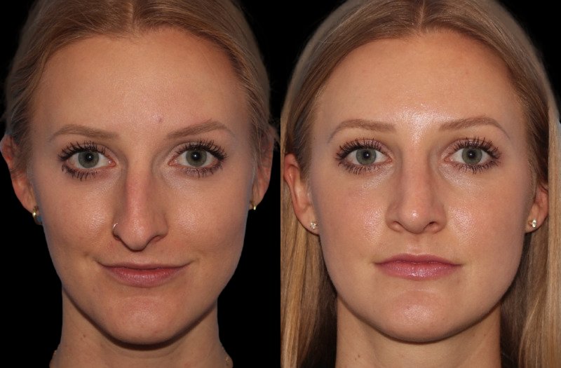 Patient 5 Combined Image