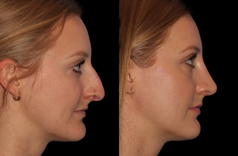 Patient 5 Combined Image