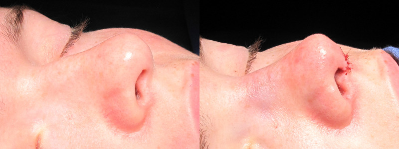 Patient 19 Combined Image