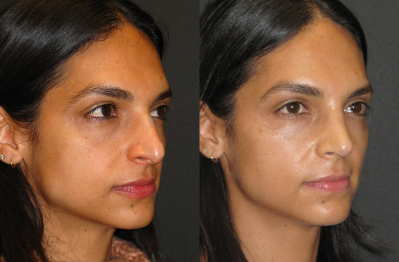 Patient 53 Combined Image