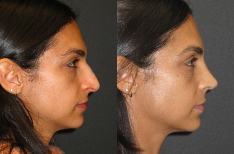 Patient 53 Combined Image