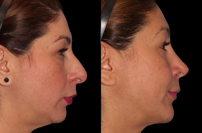 Patient 7 Combined Image