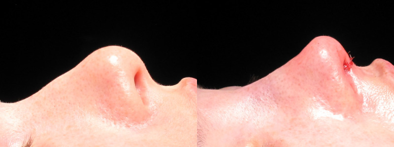 Patient 24 Combined Image