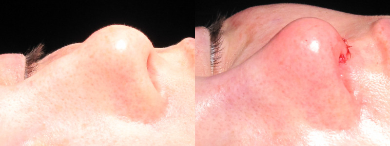 Patient 24 Combined Image