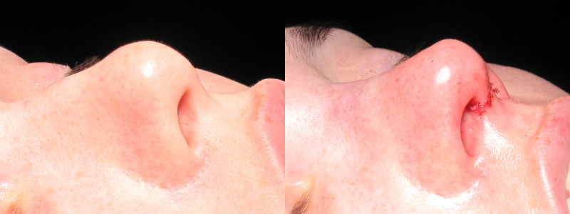 Patient 24 Combined Image