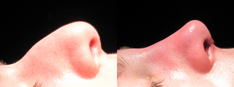 Patient 25 Combined Image