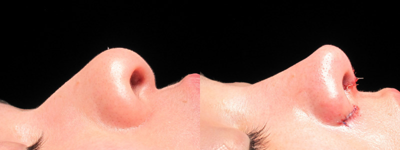 Patient 14 Combined Image