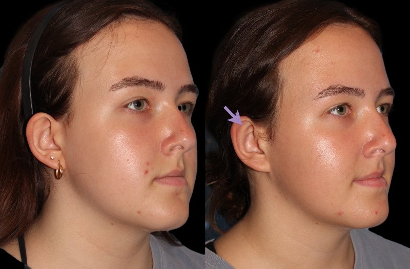 Patient 22 Combined Image