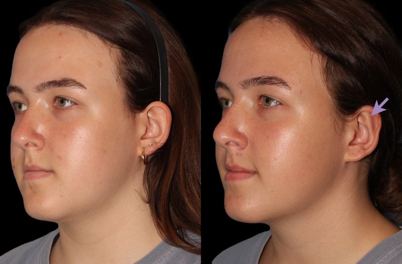 Patient 22 Combined Image