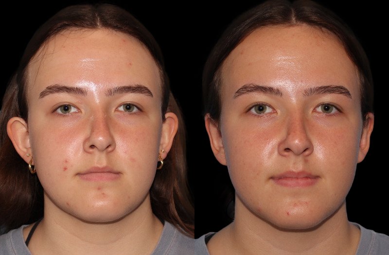 Patient 22 Combined Image