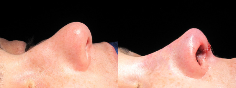 Patient 11 Combined Image