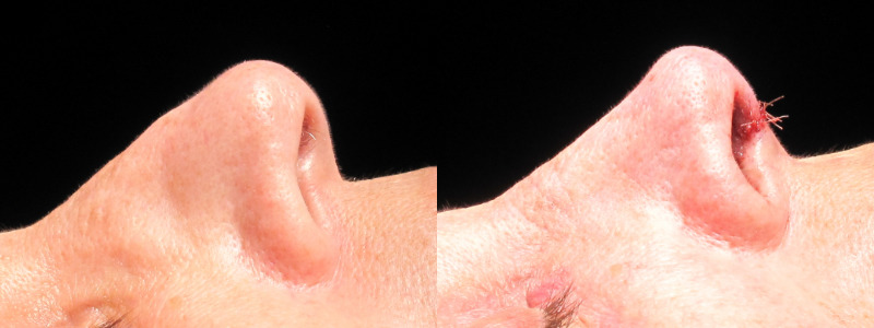 Patient 28 Combined Image